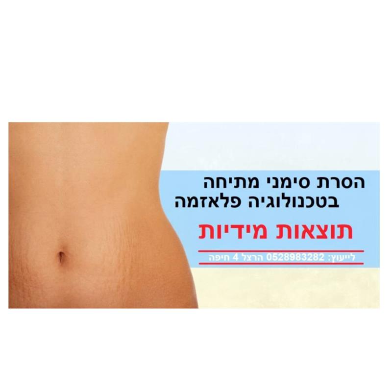 הסרת סימני מתיחה